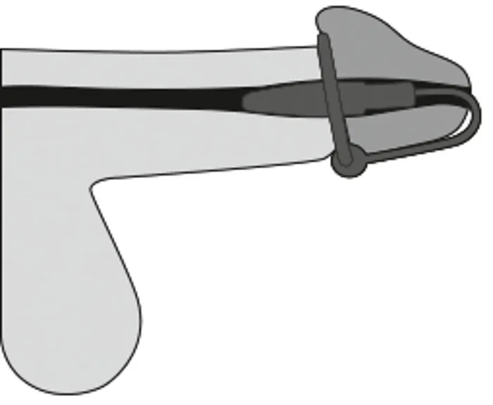Orion PenisPlug with a Silicone Glans Ring and Dilator Orion Male Sex Toys