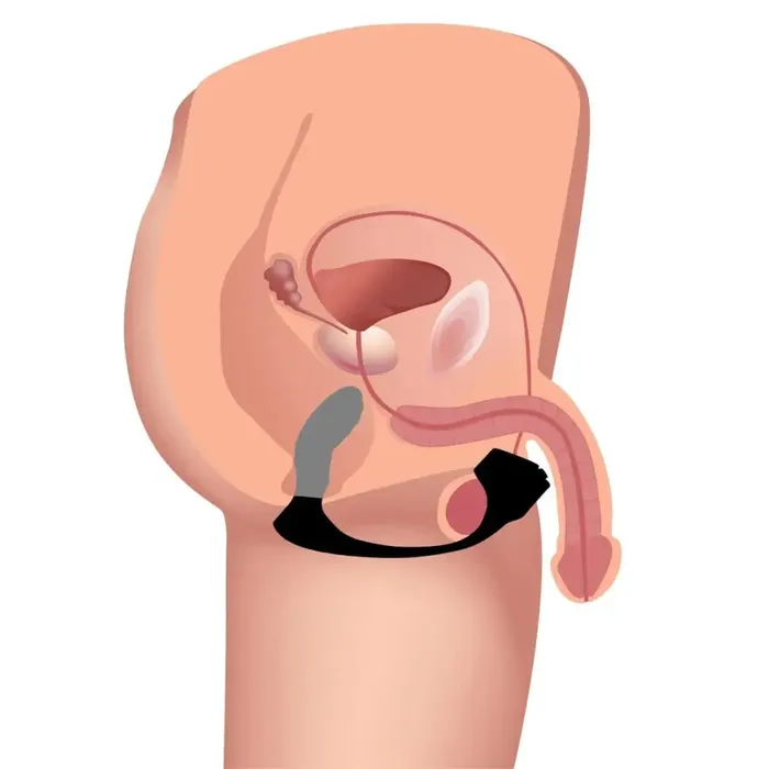7x Silicone Prostate Plug With Ball Stretcher And Remote Trinity Vibes Male Sex Toys